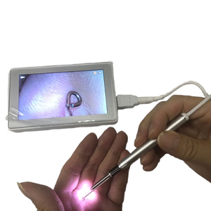 Otoscopio <span class=keywords><strong>digital</strong></span> HD con pantalla IPS de 4,5 pulgadas, herramienta de eliminación de cera para oídos, cámara con 6 luces LED - Product Image 2
