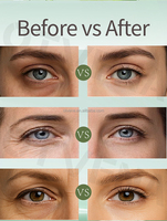 Crème Contour des Yeux OTVENA Effet Raffermissant Rapide Végétalienne Longue Durée 8h Anti-Poches et Anti-Rides Marque Privée OEM