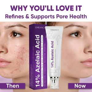 Crema OEM Personalizada de Marca Privada para el Cuidado de la Piel Facial, Tratamiento para el Acné, Crema Facial Antienvejecimiento con Ácido <span class=keywords><strong>Azelaico</strong></span> al 14% - Product Image 3