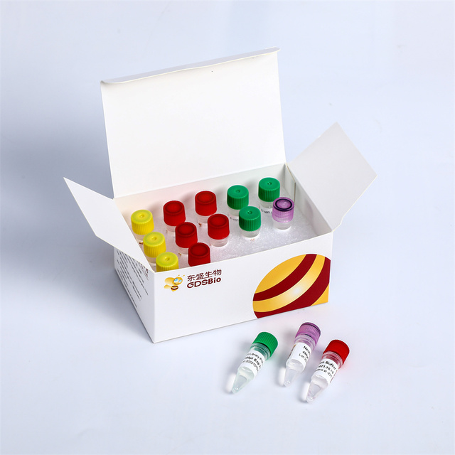 NGS Library Construction DNA RNA PCR Fast DNA Library Plus Prep Kit K004-A/K004-B