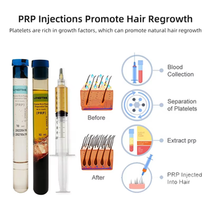 <span class=keywords><strong>Tube</strong></span> de préparation PRP 10 ml avec gel ACD pour usage clinique - Product Image 4