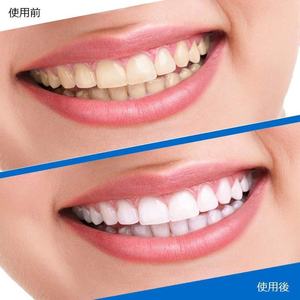 China Factory Wholesale 14 Pairs Advanced <strong>5D</strong> <strong>White</strong> Dental <strong>Teeth</strong> <strong>Whitening</strong> <strong>Strips</strong> - Product Image 5