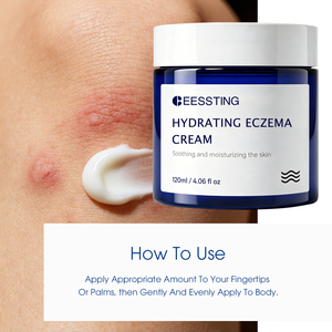 Crème hydratante réparatrice pour la peau, à logo personnalisé, soin du corps, barrière cutanée longue durée, réparation des peaux abîmées, rougeurs, sécheresse, hydratation, eczéma - Product Image 5