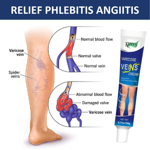 Vascular <strong>Cream</strong> <strong>Varicose</strong> <strong>Vein</strong> <strong>Cream</strong> Spider <strong>Veins</strong> Vasculitis <strong>Cream</strong> <strong>Vein</strong> Pain Ointment 20g - Product Image 2
