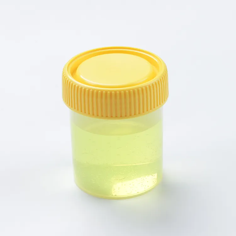 다른 표본 수집 테스트 일회용 플라스틱 멸균 의자 컵 나사 표본 소변 용기