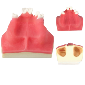 Modelo de práctica de implante dental anatómico con Molde de resina, entrenamiento de ciencia médica, hueso simulado y encías blandas, diente faltante - Product Image 1