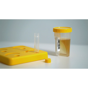Solution de manipulation des échantillons scellée avec gobelet à urine sans aiguille, tube détachable, récipient à échantillons non stérile pour les hôpitaux - Product Image 1