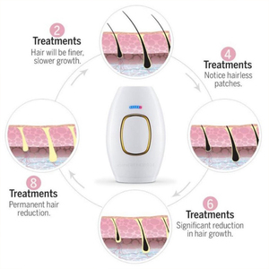 Máquina de Depilación IPL Indolora PAKISS at Home con Sensor de Contacto con <span class=keywords><strong>la</strong></span> Piel, Operación <span class=keywords><strong>en</strong></span> Inglés, Uso Doméstico para Piel Sensible - Product Image 4