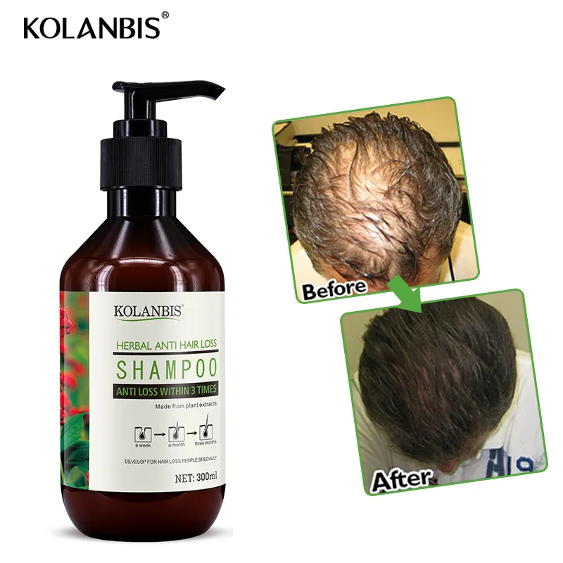 Kolanbis produit pour la perte de cheveux épais rapide croissance des cheveux shampooing pour tous les types de cheveux