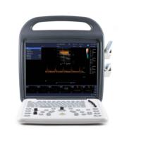 Machine à ultrasons Doppler couleur de haute précision avec technologie avancée d'ultrasons Doppler pour l'imagerie médicale