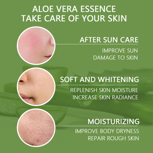 <span class=keywords><strong>Gel</strong></span> <span class=keywords><strong>de</strong></span> <span class=keywords><strong>Aloe</strong></span> <span class=keywords><strong>Vera</strong></span> Natural al por mayor <span class=keywords><strong>de</strong></span> etiqueta privada <span class=keywords><strong>Gel</strong></span> <span class=keywords><strong>de</strong></span> <span class=keywords><strong>Aloe</strong></span> <span class=keywords><strong>Vera</strong></span> hidratante calmante puro para cara y cuerpo 300g - Product Image 4