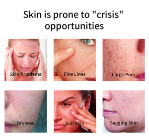 ครีมบำรุงผิวแบบจีนกรดไฮยาลูโรนิกให้ความชุ่มชื้นและซ่อมแซมผิวที่ถูกทำลาย - Product Image 4