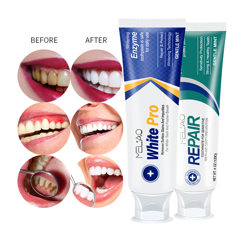 Зубная паста с органическими аминокислотами, отбеливающая зубная паста, фирменная зубная паста для домашнего и гостиничного использования