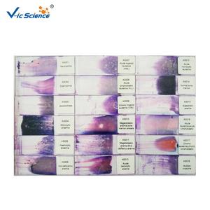 Accesorios para Microscopio a <span class=keywords><strong>Precio</strong></span> Competitivo, Portaobjetos Preparados de Hematología, Portaobjetos de Hematología para Educación, Portaobjetos Preparados para Microscopio - Product Image 1