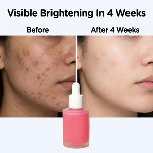 Suero Iluminador de Lujo para Blanquear y Aclarar la Piel del Rostro, para una Apariencia de Piel Joven y Luminosa - Product Image 6