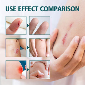 मैक्सिमथ 28.3 ग्राम ट्रिपल एंटीबायोटिक चूने मामूली कटौती खरोंच घाव घाव के निशान की मरम्मत क्रीम - Product Image 2