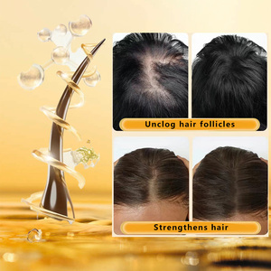 Aceite de Batana natural puro de marca privada 100% para el crecimiento del cabello, tratamiento orgánico anticaída de cabello, reparación de daños, mantequilla de Batana - Product Image 4