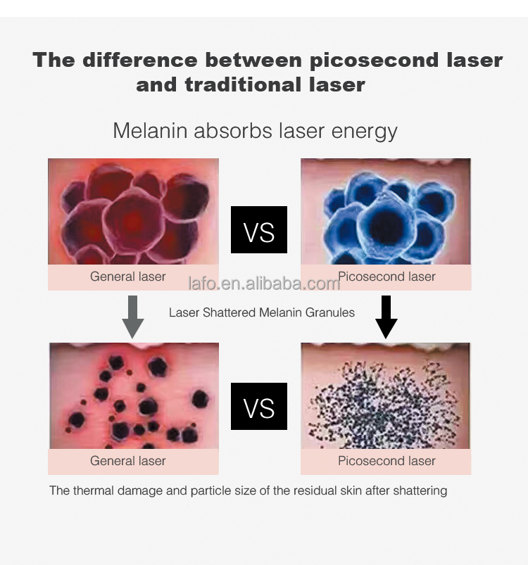 picosecond pico laser 755nm laser tattoo removal machine with honeycomb /picosecond /1320nm black doll head three heads
