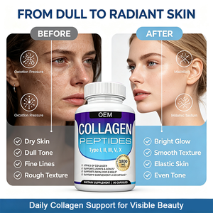 Cápsulas <span class=keywords><strong>de</strong></span> Colágeno Multi-Péptidos <span class=keywords><strong>de</strong></span> Marca Privada OEM Tipo I, II, III, V, X con Vitamina C y Ácido Hialurónico para la Luminosidad <span class=keywords><strong>de</strong></span> la Piel, 90 Cápsulas - Product Image 2