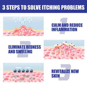 30 밀리리터 건선 릴리프 스프레이, 벌킹 방지 습진 및 피부염 가려움증 방지 스프레이 - Product Image 4