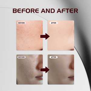 อัลฟ่า-อาร์บูติน TXA ไซไดด์ เพียว เซรั่ม ลดเลือนจุดด่างดำ ปรับสีผิวให้สม่ำเสมอ สารต้านอนุมูลอิสระ เหมาะกับทุกสภาพผิว ใช้ได้ทุกวัน เช้า-เย็น 50 มล. - Product Image 3