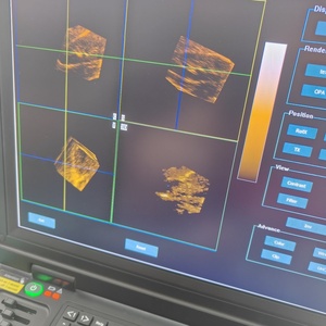 Échographe Doppler Couleur Portable pour Ordinateur Portable avec Logiciel 3D – Appareil d'Échographie Doppler pour Gynécologie, Cardiologie, Vétérinaire et Échographie de Grossesse CU20 - Product Image 6