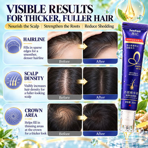 Sérum anti-chute de cheveux au ginseng, traitement de la calvitie, sérum capillaire au Polygonum Multiflorum, sérum stimulant la croissance des cheveux au gingembre - Product Image 3