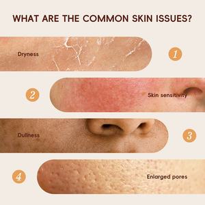 Tónico Facial LAIKOU 100ml con Leche de Arroz y Hamamelis, Hidratante y Refrescante para una Piel Saludable - Product Image 2