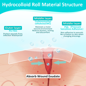 العلامة التجارية HDS لاصقة غروانية مائية ضمادات تضميد الجروح فائقة الامتصاص مقاومة للماء مرنة معقمة ذاتية اللصق نفطة حرق حب الشباب - Product Image 3