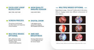 กล้องวิดีโอเอนโดสโคปสัตวแพทย์ระบบกล้องสองในหนึ่งเดียวและแหล่งกำเนิดแสงสำหรับโรงพยาบาลสัตว์เลี้ยง - Product Image 6