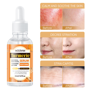 Suero Calmante de Cúrcuma de Marca Privada 30ML para un Tono Uniforme, Reafirmante, Calmante y Reparador, Suero Facial Popular de Cúrcuma OEM MOOYAM - Product Image 1