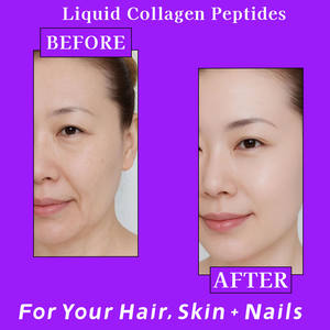 Sachets de peptides liquides oraux de <span class=keywords><strong>collagène</strong></span> personnalisés de qualité supérieure <span class=keywords><strong>Collagène</strong></span> marin biotine CoQ10 Vitamines C E Soutient la santé des cheveux, de la peau et des ongles - Product Image 5