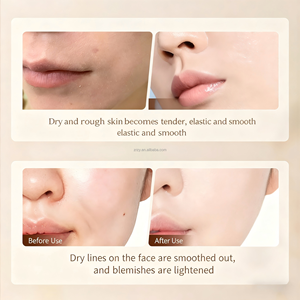 Desobstruye los Poros, Reduce las <span class=keywords><strong>Cicatrices</strong></span> del Acné, <span class=keywords><strong>Aceite</strong></span> Natural <span class=keywords><strong>de</strong></span> Bergamota, Vitamina C, Reduce la Caspa y Calma la Picazón del Cuero Cabelludo Graso - Product Image 4