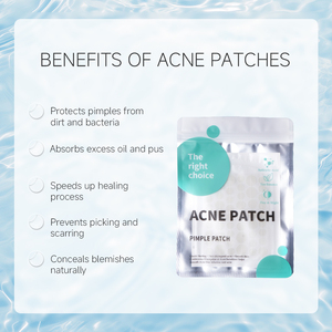 แผ่นแปะสิวไฮโดรคอลลอยด์สำหรับใบหน้าที่มีกรดซาลิไซลิกน้ำมันต้นชาดาวเรืองสติกเกอร์ติดจุดรักษาสิวที่แข็งแกร่งดูดซับสิว - Product Image 3