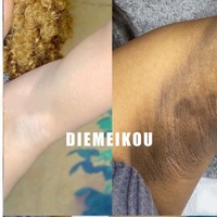 Crème éclaircissante la plus puissante pour les parties intimes OEM 7 jours Correcteur des taches foncées Aisselles, jambes, genou, coude Crème éclaircissante pour les aisselles