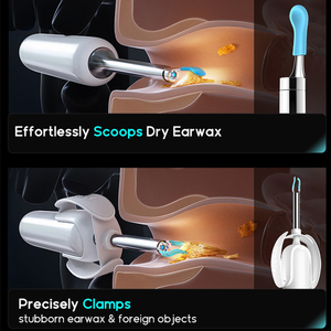 适用于Bebird H30S 4合1内窥镜摄像机耳除蜡助手软件功能分析AI耳健康软件 - Product Image 5