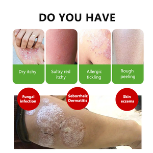 DOCTOON Naturel Plante Chinoise <span class=keywords><strong>Visage</strong></span> Corps Crème Anti-Démangeaisons Eczéma Dermatite Inflammation Éruptions Traitements Psoriasis Peau <span class=keywords><strong>Pommade</strong></span> - Product Image 6