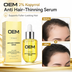 เซรั่มบำรุงหนังศีรษะ OEM 2% โคปีรอล ป้องกันผมบาง 50 มล. ผสมไบโอติน ขิง และใบบัวบก สำหรับผมแตกปลายและบำรุงรากผม จำหน่ายส่ง - Product Image 1