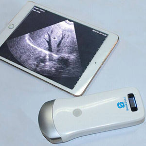 Susured C3.5 Wifi Ultrasound <span class=keywords><strong>Probe</strong></span> nirkabel Ultrasound <span class=keywords><strong>Probe</strong></span> 3.5 MHZ 80 elemen mesin Ultrasound - Product Image 3