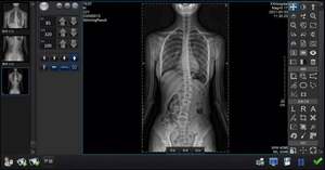 電動<span class=keywords><strong>DR</strong></span>フラットパネルX線検出器CRシステム付きデジタルIRAYテクノロジー放射線機器 & アクセサリー - Product Image 5