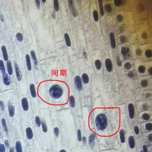 Juego de Portaobjetos de Mitosis de Células de la Punta de la Raíz de <span class=keywords><strong>Cebolla</strong></span> (2N=16) Observa el Arreglo Mitótico de las Células <span class=keywords><strong>en</strong></span> la Zona Meristática de la <span class=keywords><strong>Cebolla</strong></span> - Product Image 3