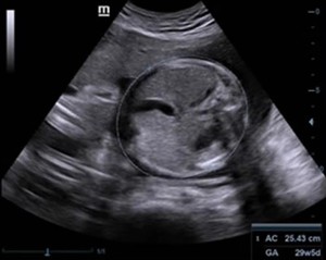 Máy siêu âm Mindray Z50S, thương hiệu Mindray, máy siêu âm di động, máy siêu âm Doppler màu, máy siêu âm xách tay - Product Image 4