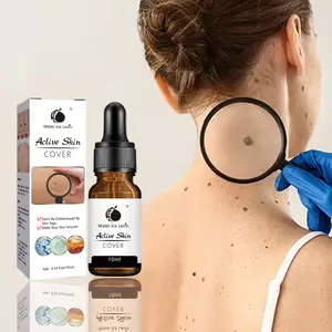 Facial black spot remover for pigmentation treatment of melasma and freckles Suitable for all skin types