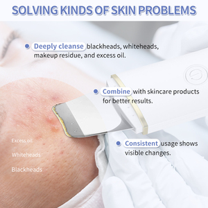 Nhà Máy Bán Hàng Trực Tiếp Nhà Vẻ Đẹp Da Scrubber Máy Xách Tay Mặt Vỏ Da Scrubber Thiết Bị Cho Khuôn Mặt Chăm Sóc Làm Bằng Silicone - Product Image 2