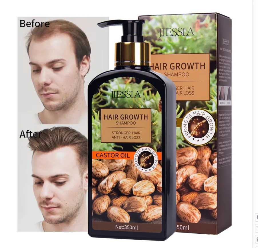 350ml castor oil long hair growth shampoo