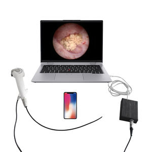 Hot-venda Premium Factory-Direct HD flexível descartável Coledocoscópio para diagnóstico médico - Product Image 1