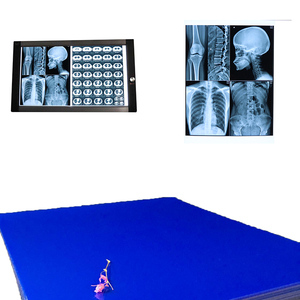 Film laser médical sec 11x14 pouces à base bleue pour imagerie CT, IRM, DR, compatible avec les imageries <span class=keywords><strong>Agfa</strong></span>, Fuji, Carestream - Product Image 1