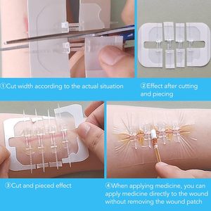 Vendajes para cierre de heridas, tiras de cierre de heridas, alternativa a los puntos para pequeños cortes y laceraciones - Product Image 2