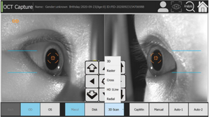 Tecnología avanzada, alta precisión, el mejor precio y gran venta en el mercado, OCT, tomografía de Coherencia Óptica, OCT - Product Image 6