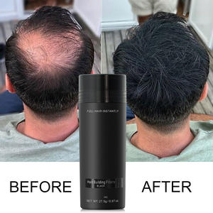 Nuovo Arrivo Fibre per Capelli Infoltenti da 27.5g Naturali e Morbide per Trattamento Contro la Calvizie e la Caduta dei Capelli - Product Image 4